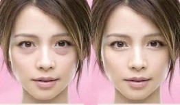 新疆整形爆料案件最新进展