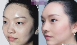 新疆整形爆料案件最新进展